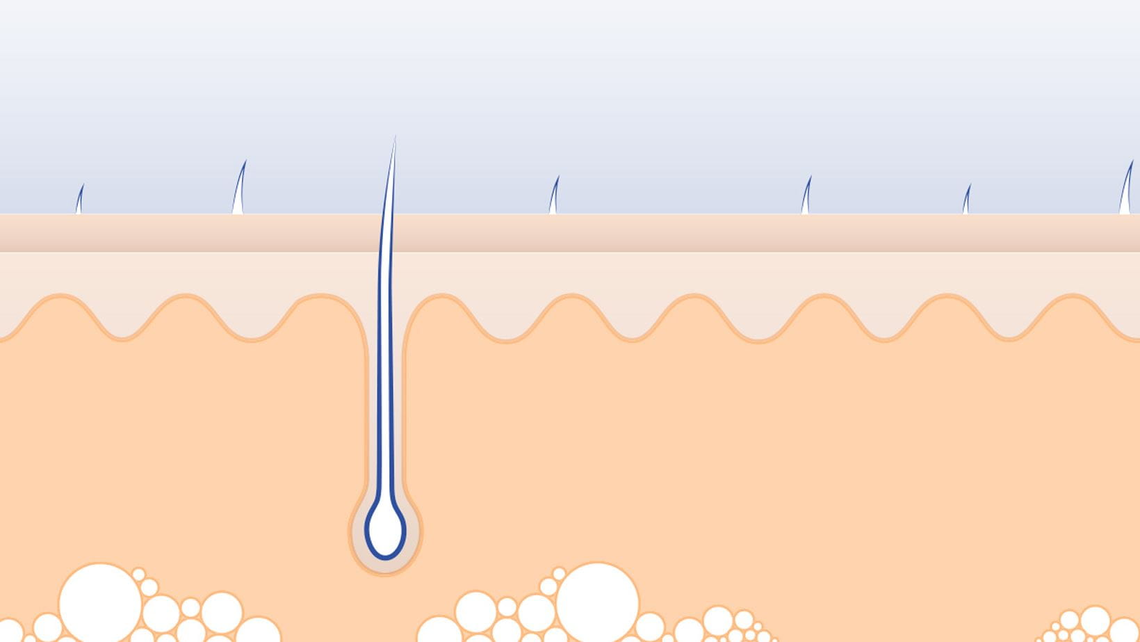 Dermis