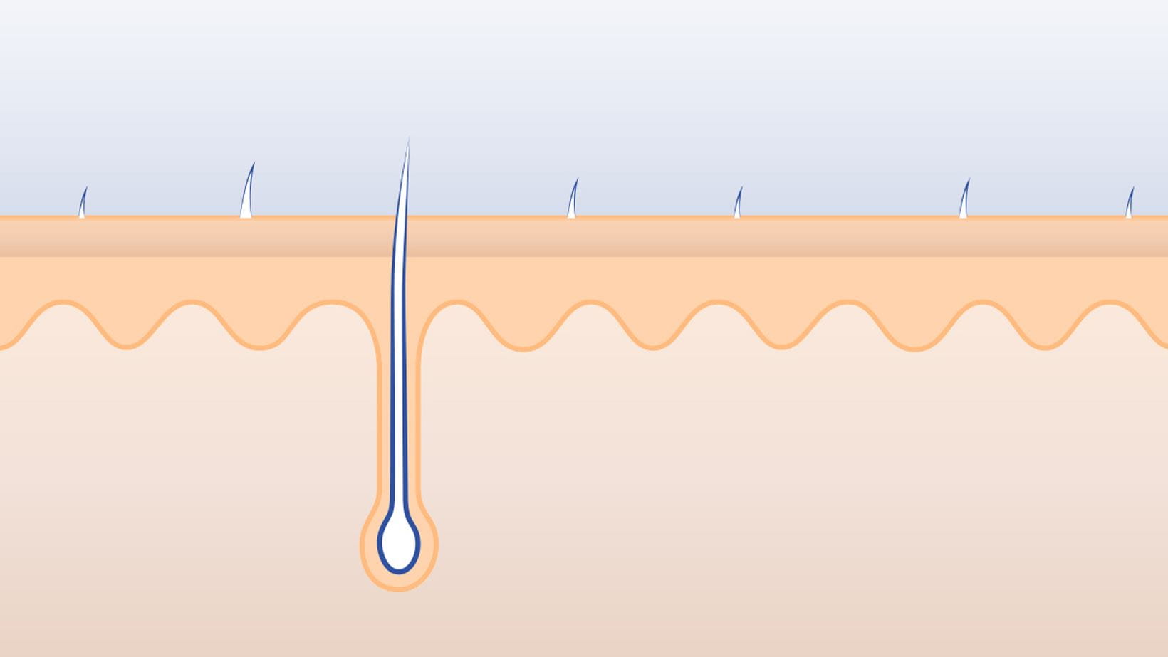Epidermis