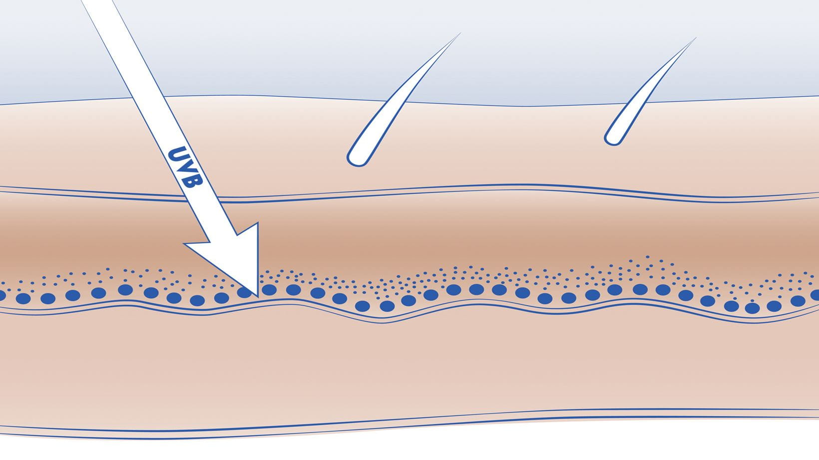 UVB Strahlung