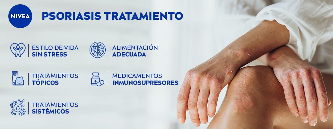 Psoriasis: síntomas y posibles causas