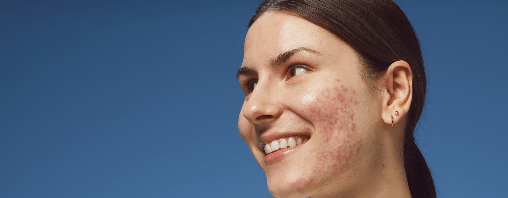 Blonde Frau lächelt