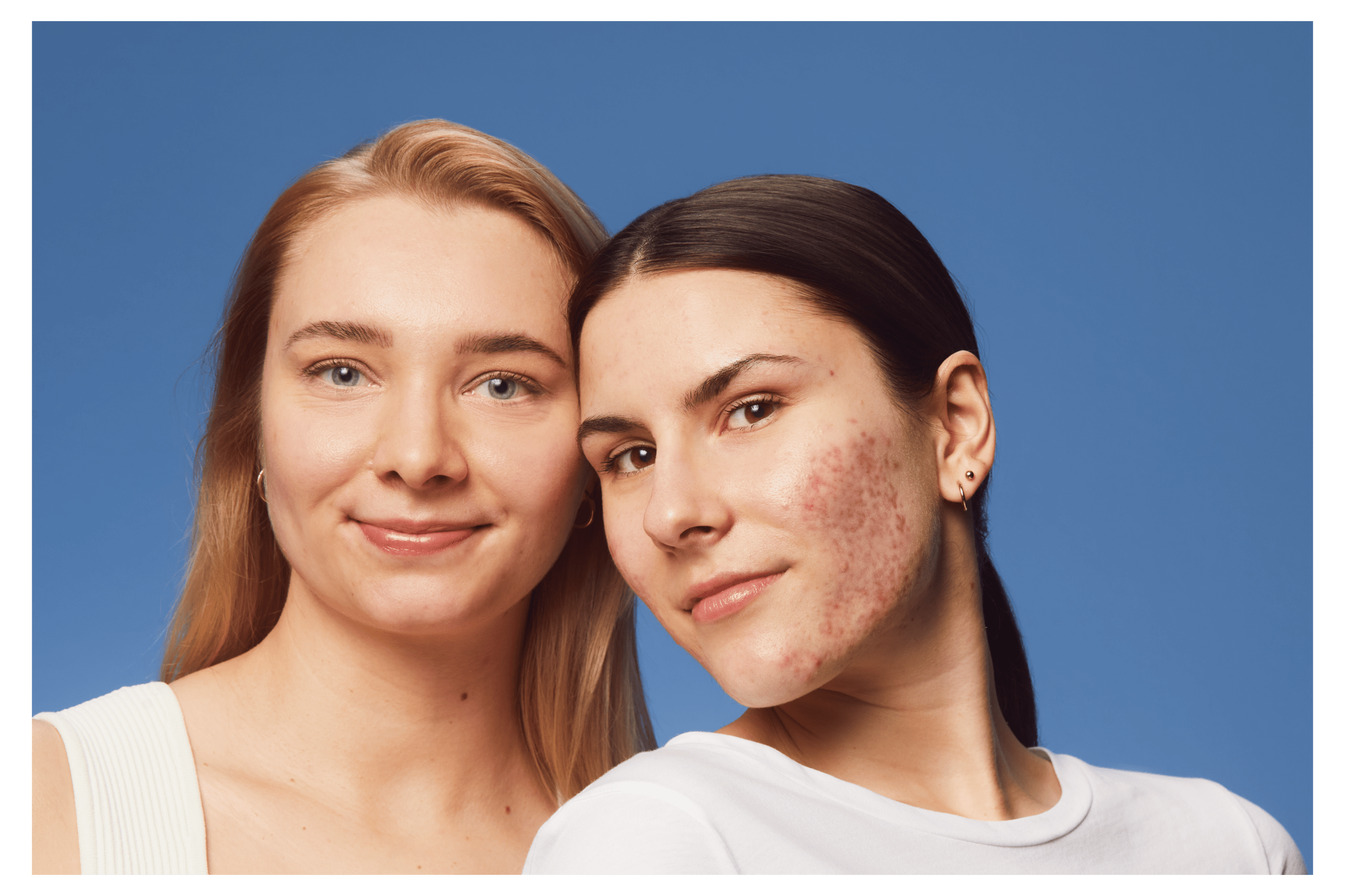 blonde woman smiling