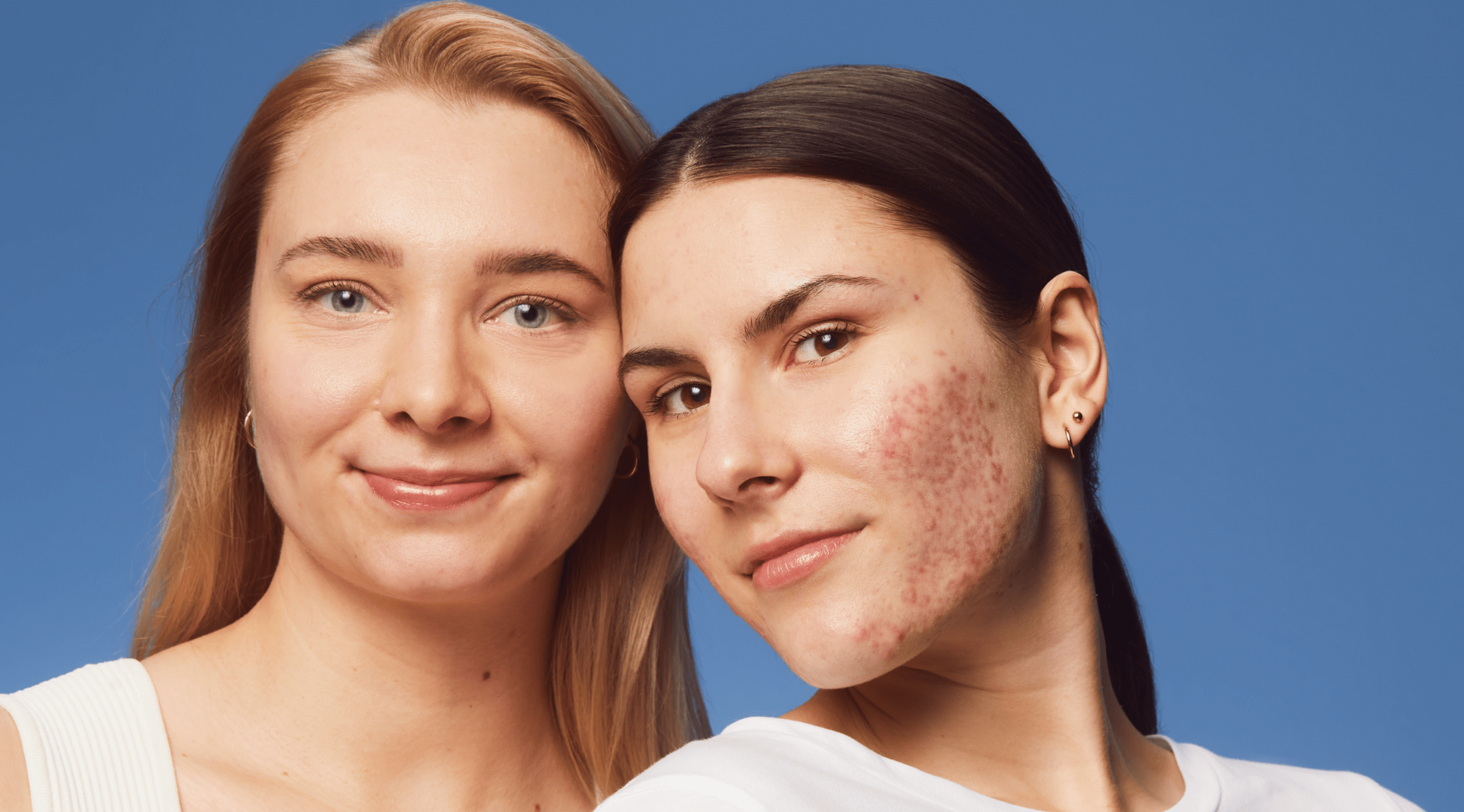 blonde woman smiling