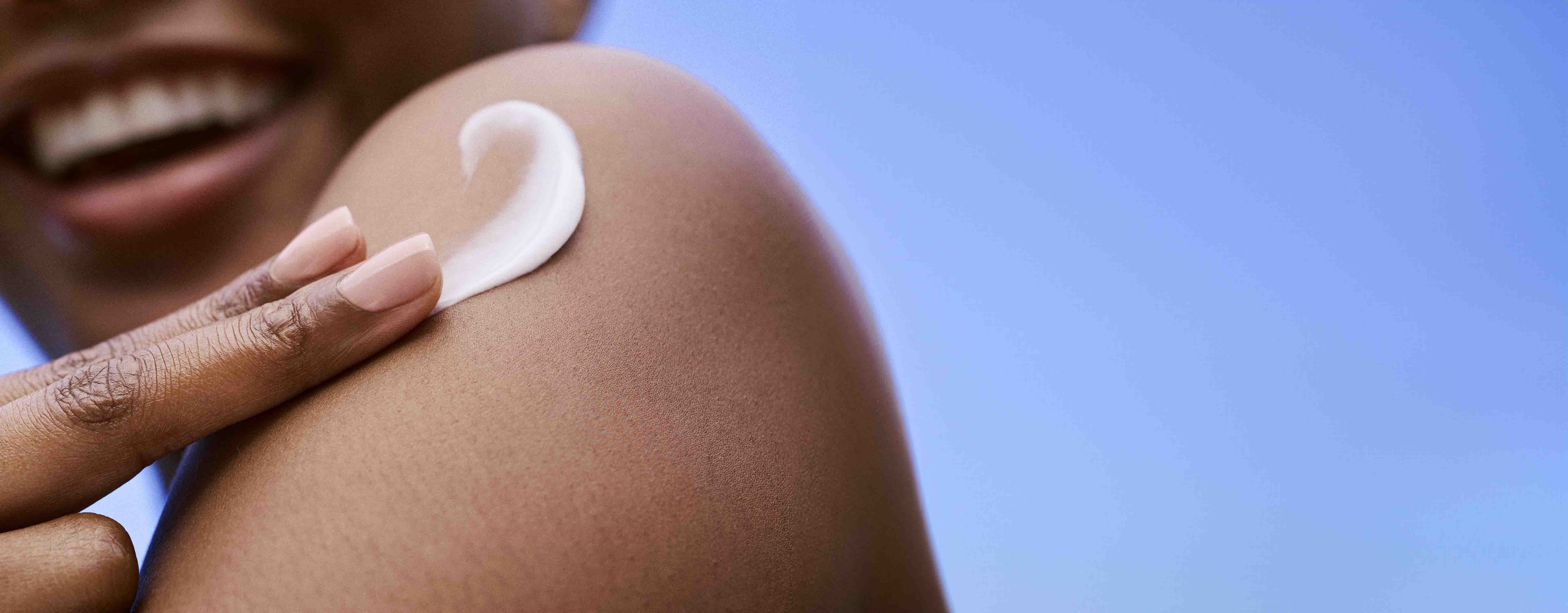 Segala Hal yang Perlu Kamu Ketahui Tentang Hiperpigmentasi