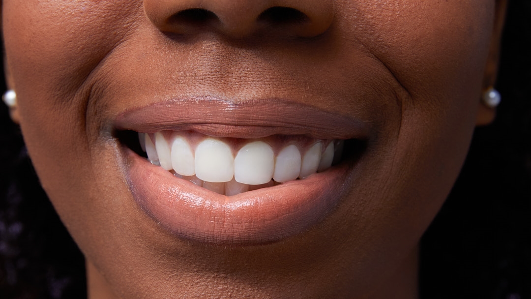 Lip Balm yang Cocok untuk Bibir Kering