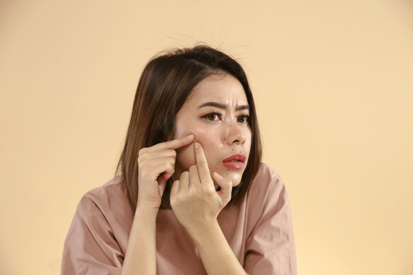 Woman picking acne