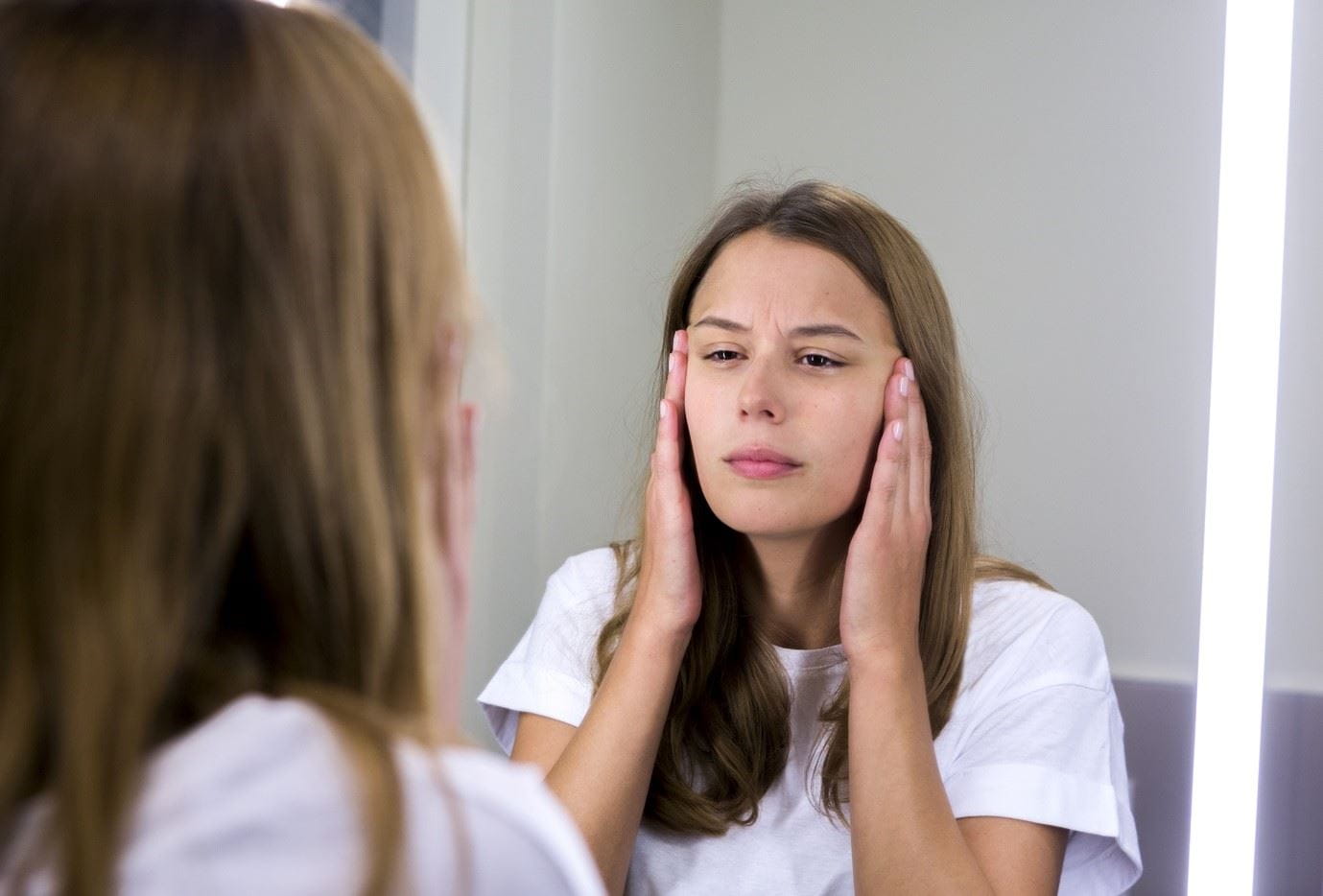 Tips for an acne-free Winter Complexion