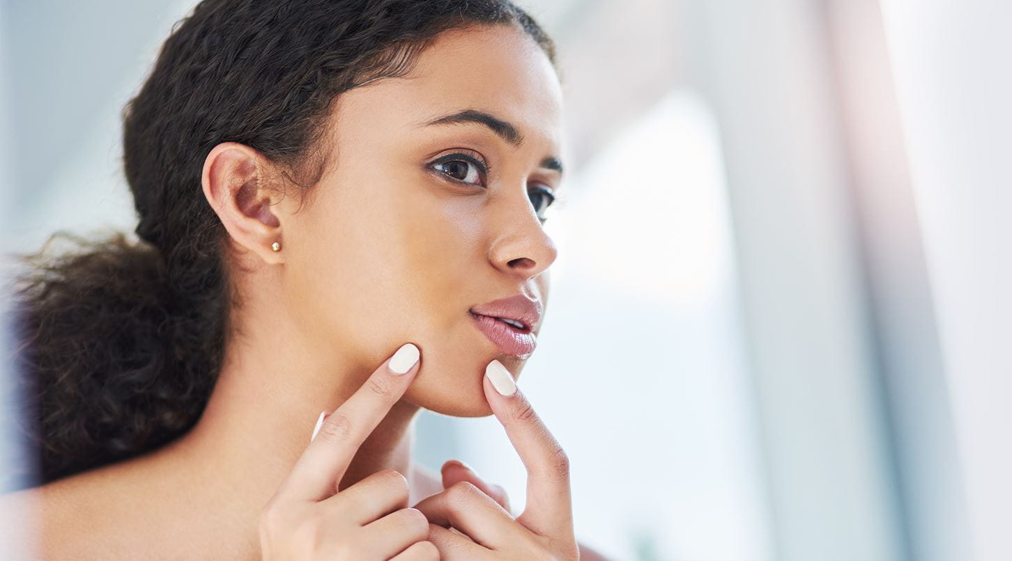 bollicine sottopelle