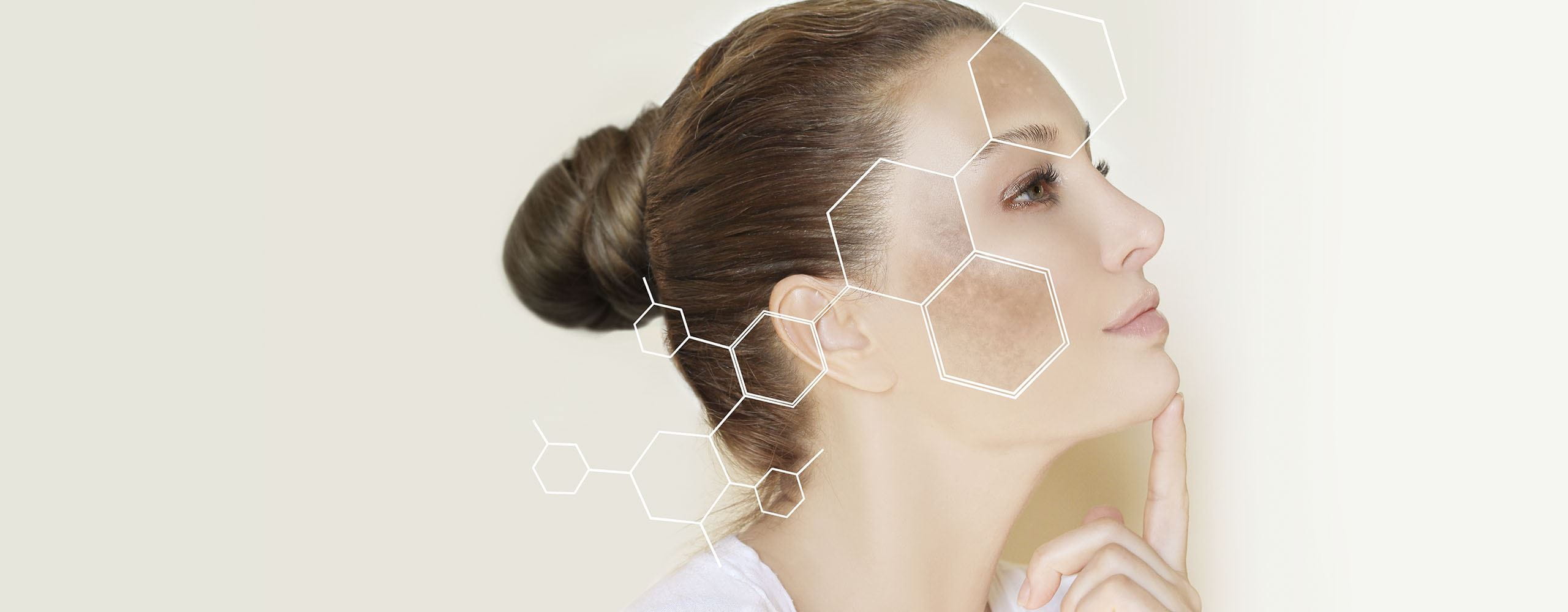 manchas de sol en la cara