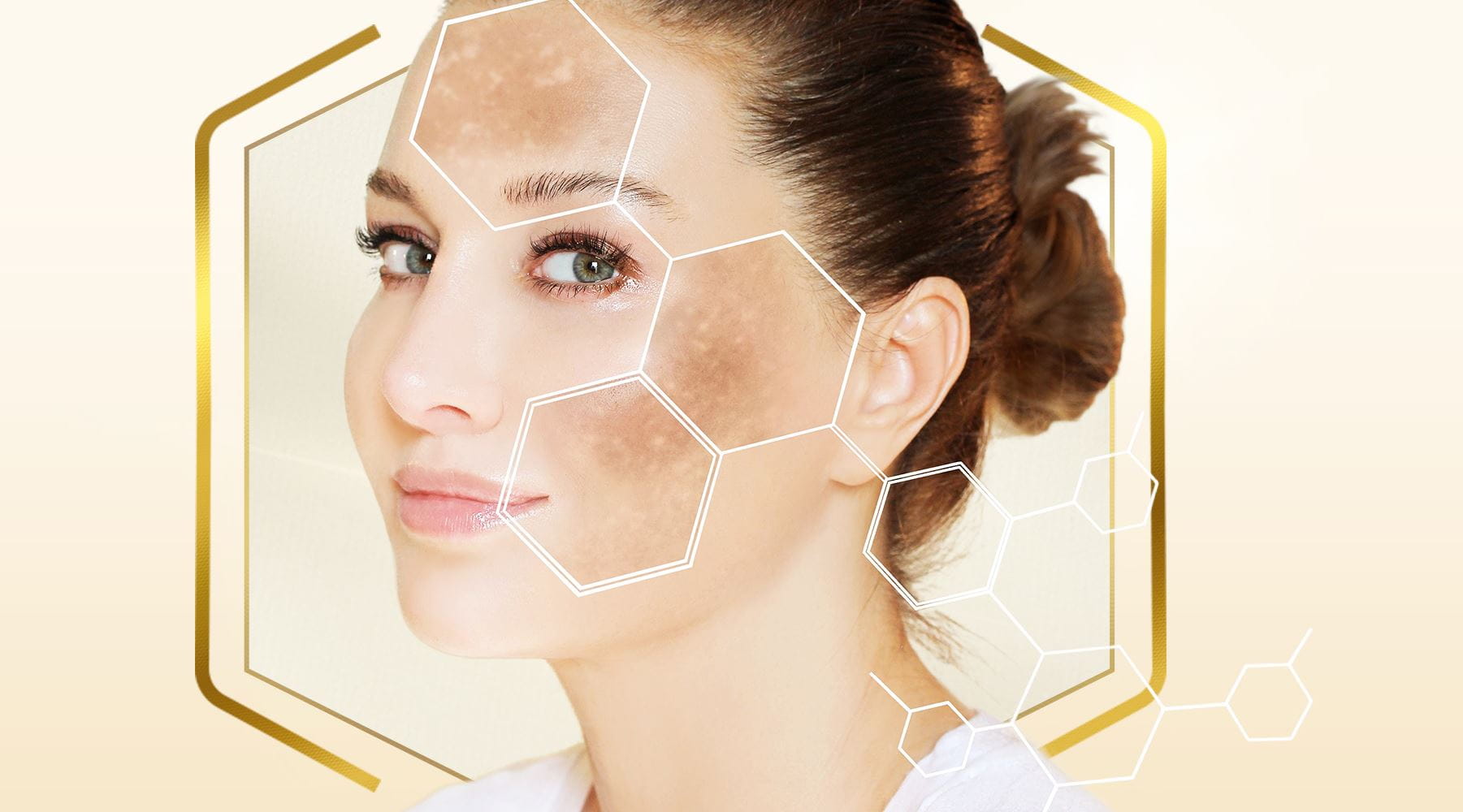 manchas de sol en la cara