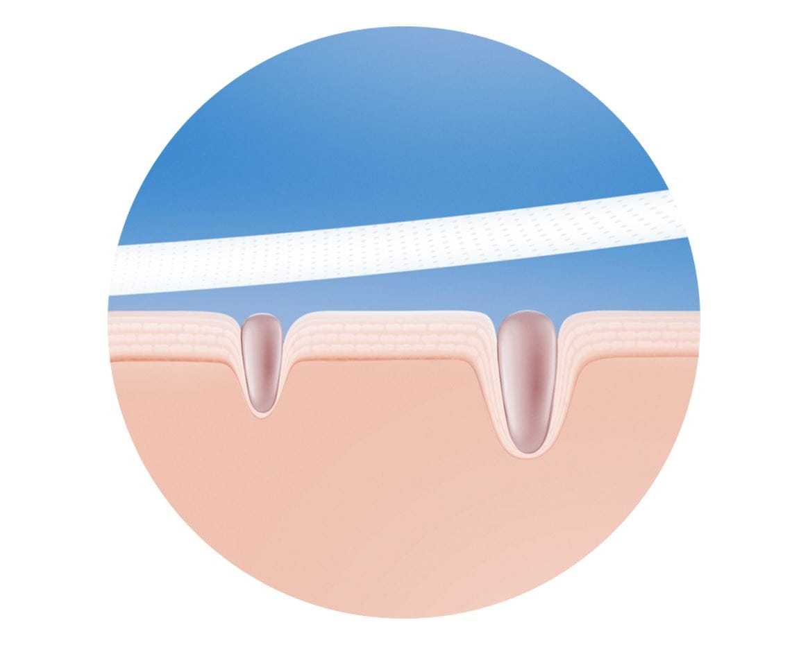 pore-purifying