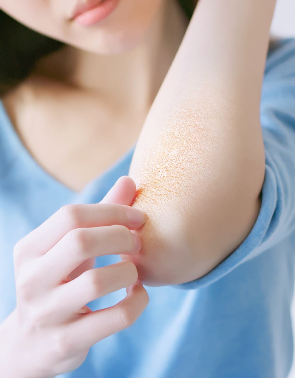 เคล็ดลับดูแลผิวแห้งคัน