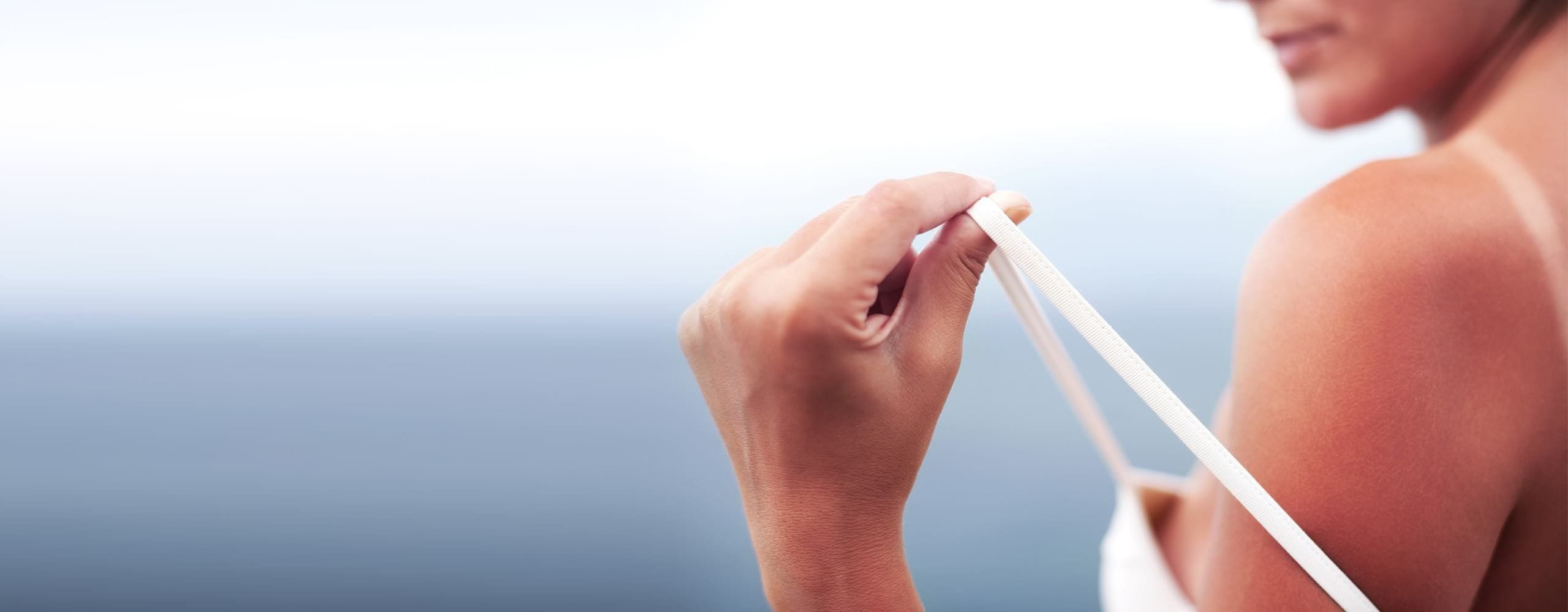 10 วิธีกู้ผิวคล้ำแดด ให้กลับมาดูกระจ่างใสเร่งด่วน