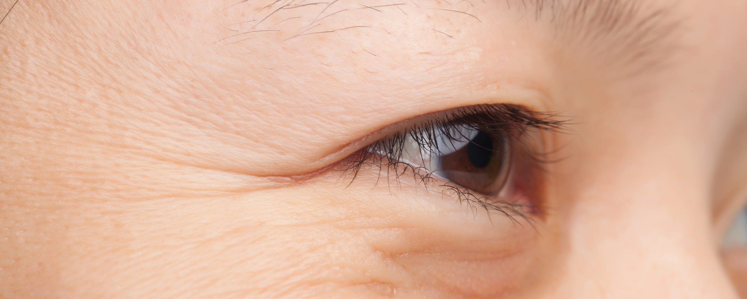 11 วิธีแก้ริ้วรอยใต้ตา เห็นผลจริงฉบับทำได้เองแบบง่ายๆ