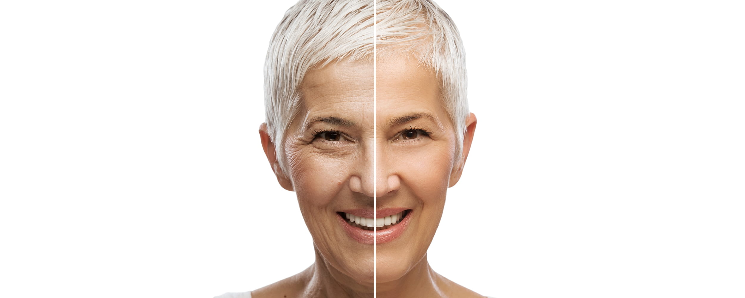 เคล็ด(ไม่)ลับแก้ปัญหาผิวหน้าเหี่ยวย่นให้เห็นผลจริง