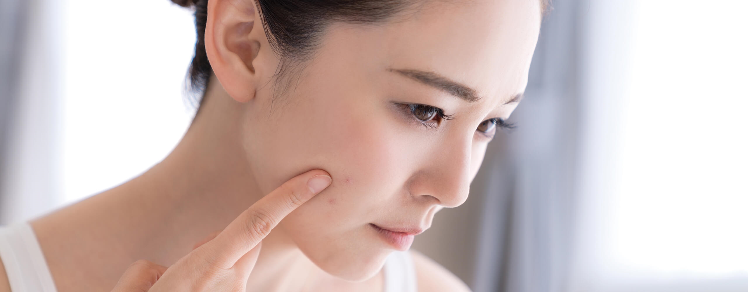 รู้ชนิดของจุดด่างดำ และรอยดำบนใบหน้าพร้อม 11 วิธีรักษาเห็นผลจริง