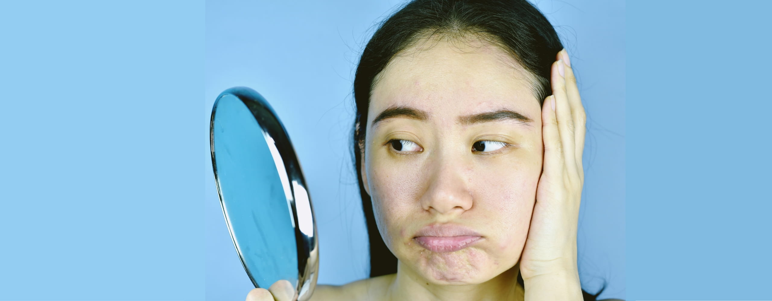 ผิวหมองคล้ำ ไม่มีราศี แก้ยังไง? รวม 5 วิธีดูแลผิวให้กลับมาสดใส