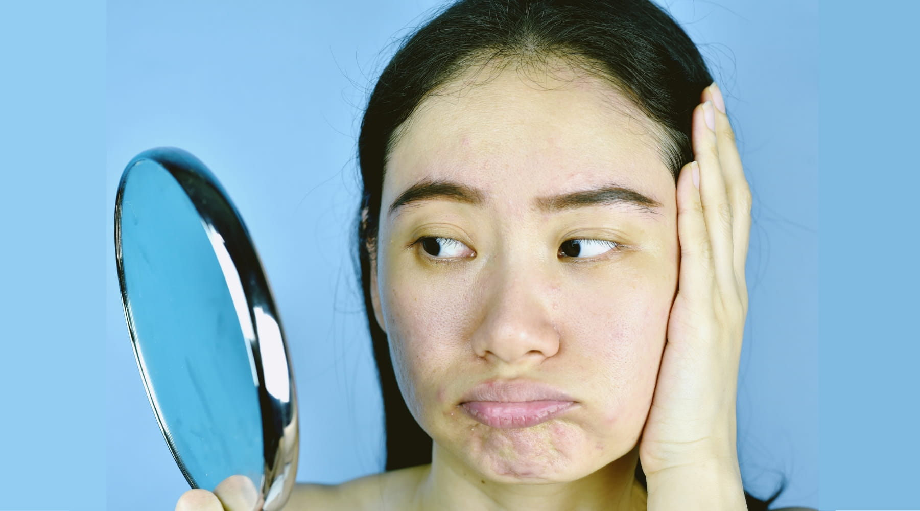 ผิวหมองคล้ำ ไม่มีราศี แก้ยังไง? รวม 5 วิธีดูแลผิวให้กลับมาสดใส