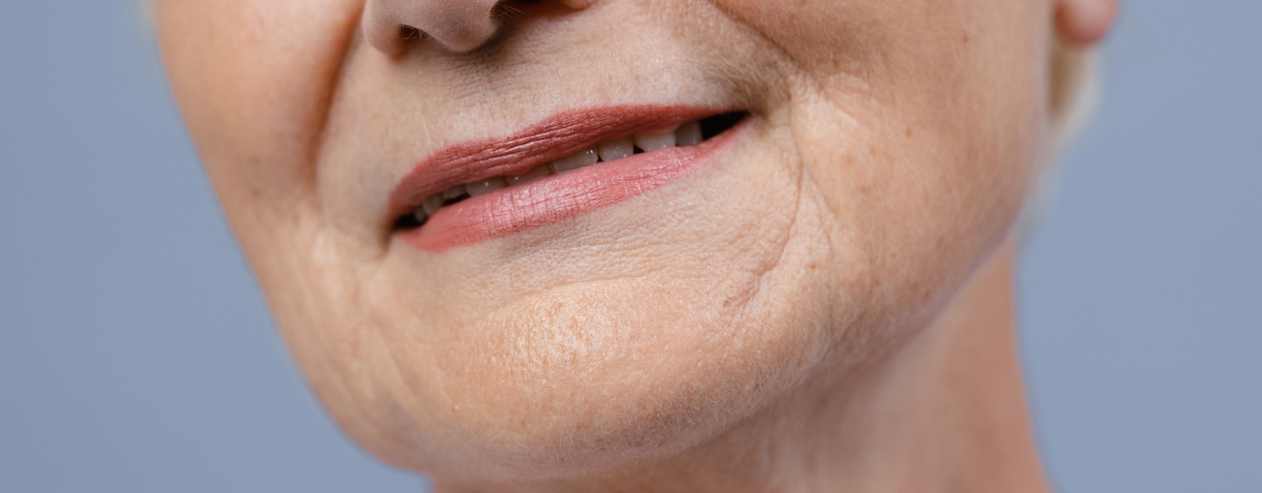 ร่องน้ำหมาก คืออะไร? สาเหตุ และ 6 วิธีแก้ไขให้ตื้นขึ้น