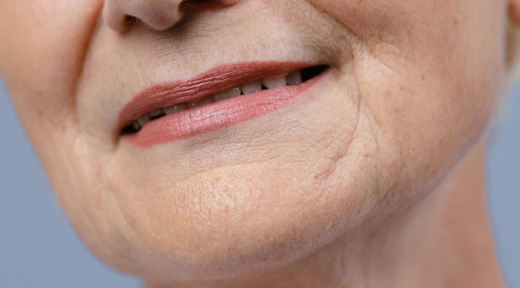 ร่องน้ำหมาก คืออะไร? สาเหตุ และ 6 วิธีแก้ไขให้ตื้นขึ้น