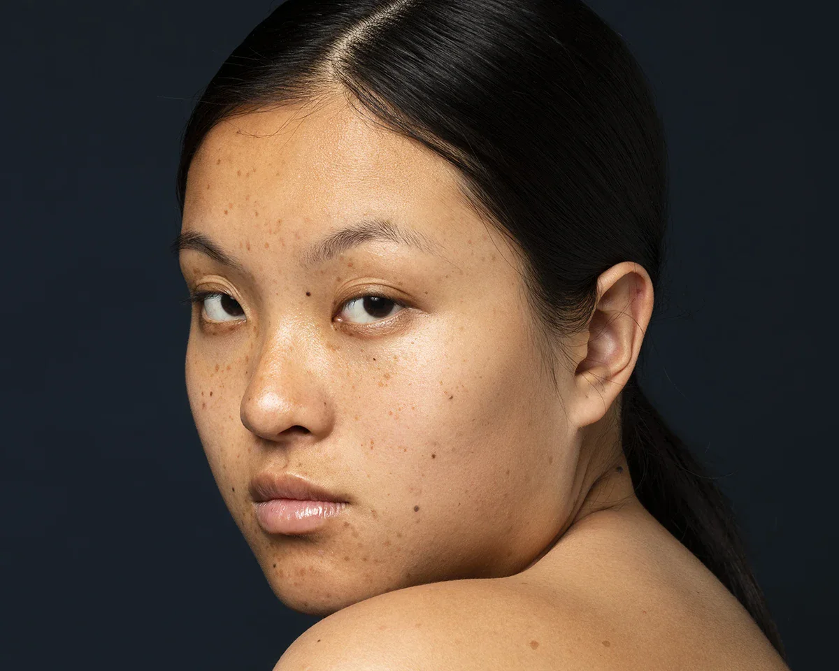 กระตื้น คืออะไร