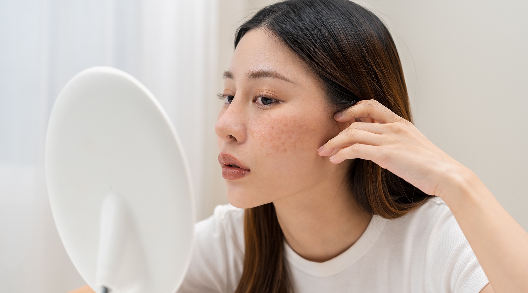 รวม 5 วิธีรักษาฝ้าด้วยวิธีธรรมชาติ เห็นผลจริงใน 7 วัน