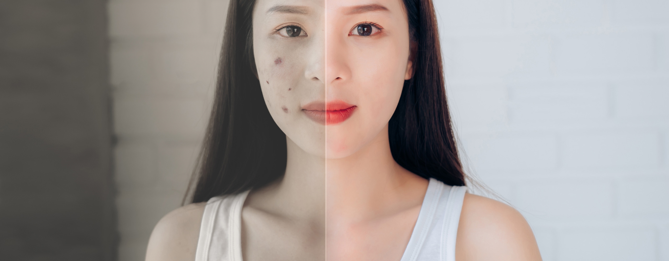 รวม 12 วิธีทำให้หน้าใส ไร้สิว หน้าเนียน แบบธรรมชาติ