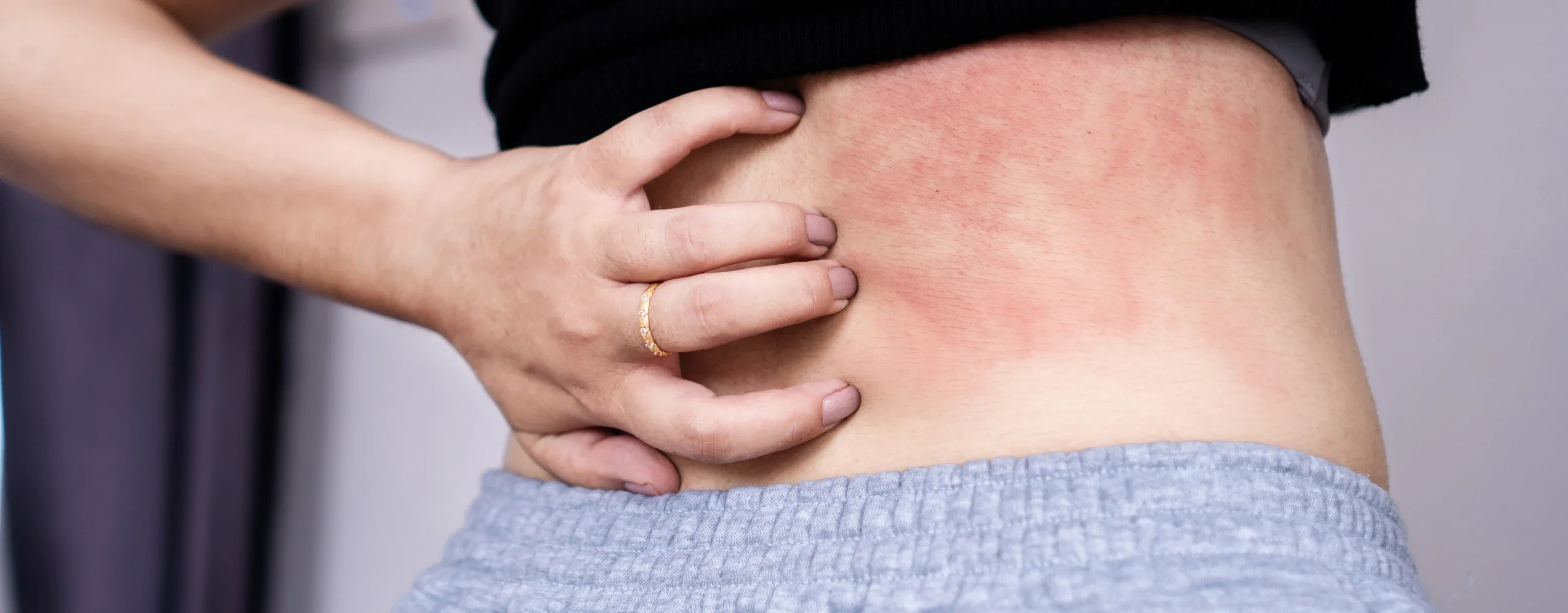 4 ครีมทาผิวแห้งตัวดังจาก NIVEA กู้ผิวพัง แห้งคัน ให้กลับมาเนียนนุ่ม ชุ่มชื้นยาวนาน