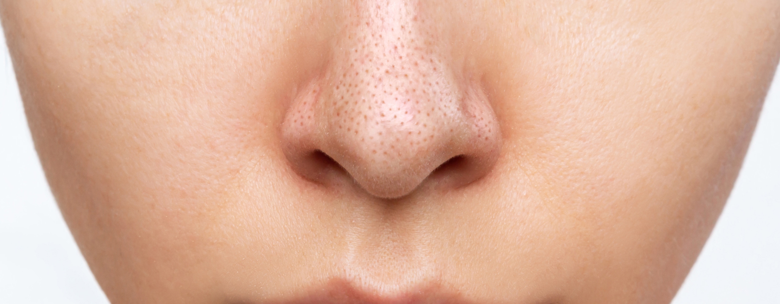 สิวเสี้ยน สาเหตุ อาการ คืออะไร รวม 3 วิธีจัดการให้ผิวเนียนใส