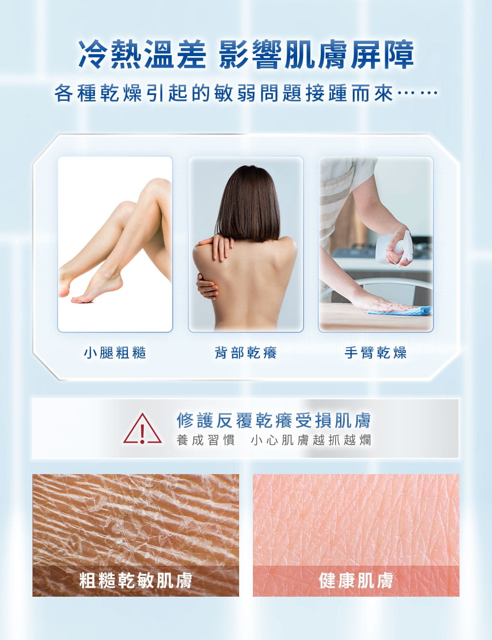 冷熱溫差 影響肌膚屏障，各種乾燥引起的敏弱問題接踵而來
